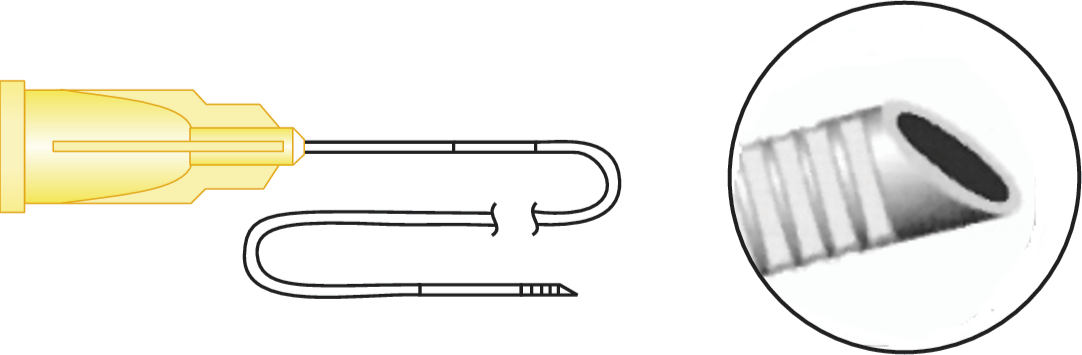 Anterior Chamber Maintainer (Lewicky)